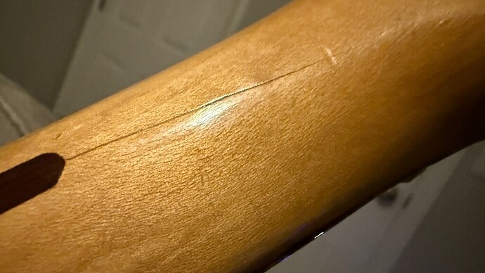 hairline-neck-IMG_1618